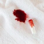 Blut im Urin - Symptome, Ursachen und Behandlung