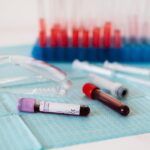 Blut im Urin - Symptome und Ursachen analysieren