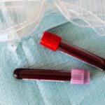 Blut im Urin - Symptome, Ursachen und Behandlungen