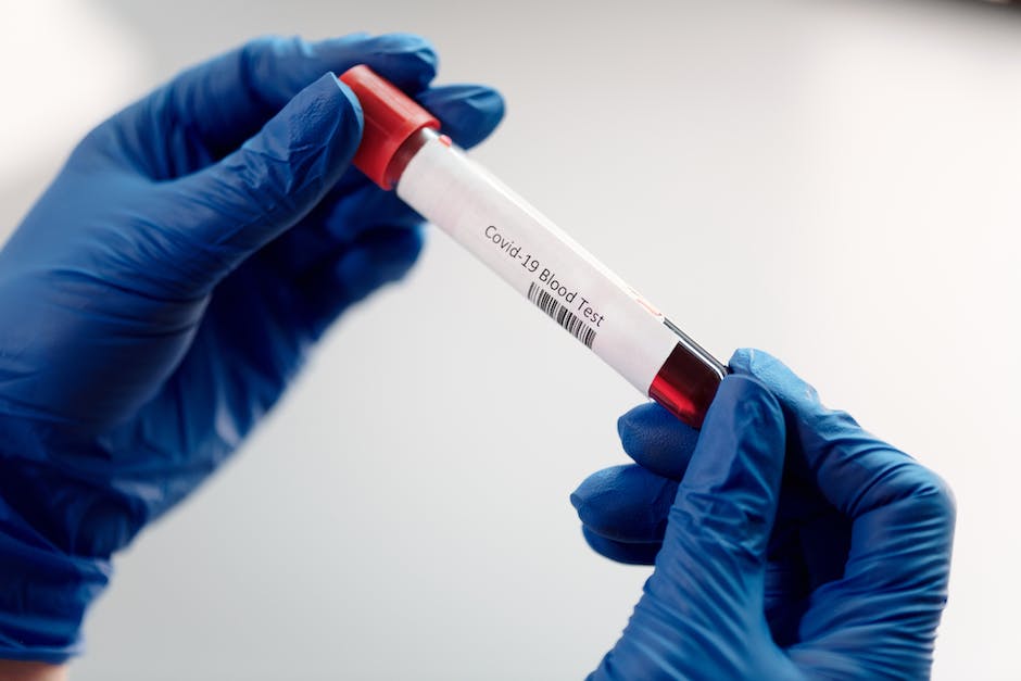Blutabnahme-Tests zur Überprüfung der Gesundheit